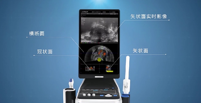 前列腺手術(shù)醫(yī)療設(shè)備產(chǎn)品三維動(dòng)畫(huà)視頻案例-深圳映畫(huà)傳媒三維動(dòng)畫(huà)制作案例